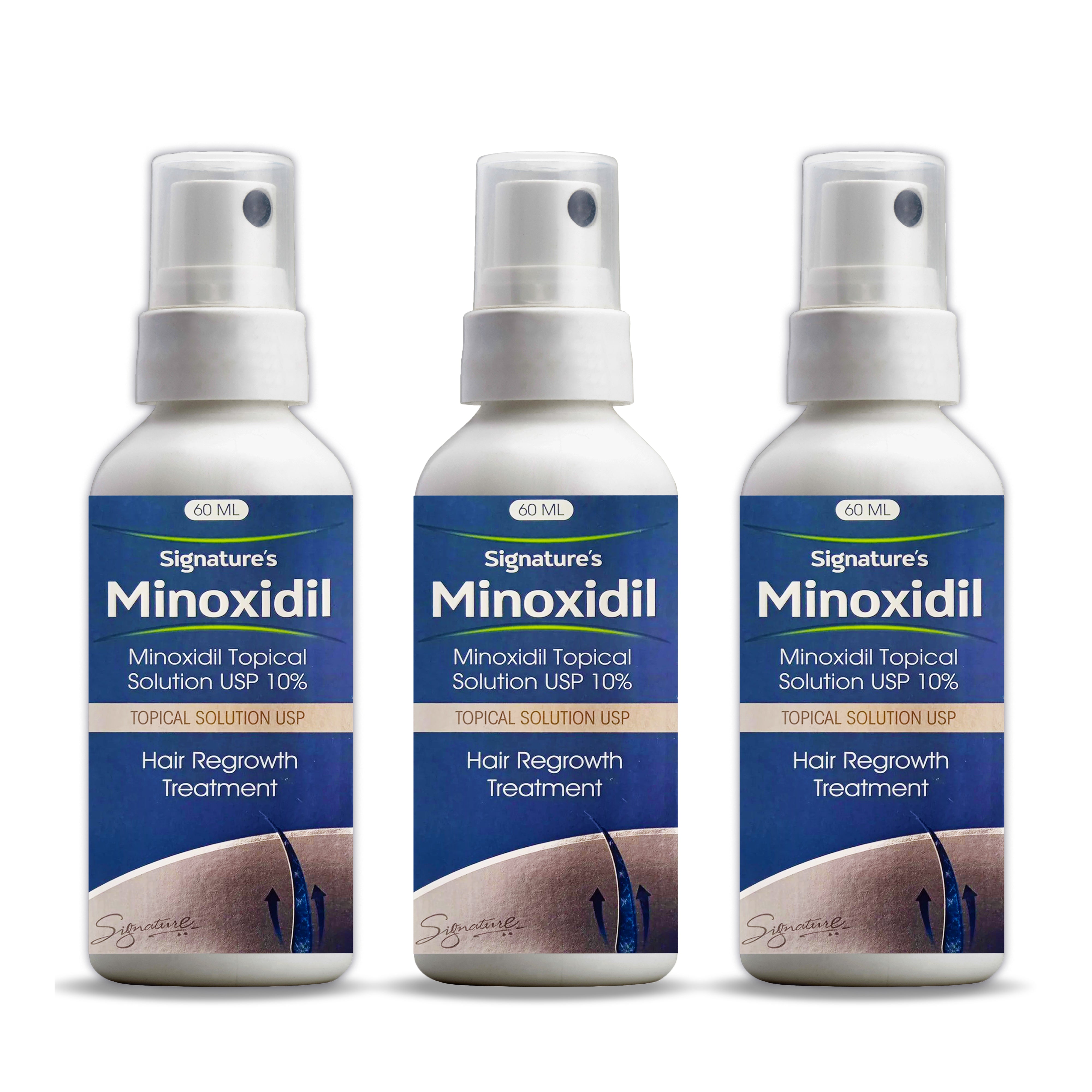 Signature's Minoxidil 10%  1 Month Supply [ 1 x 60ml]